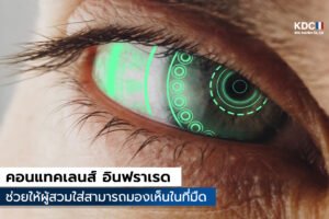 contact lenses
