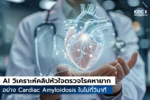 EchoGo Amyloidosis