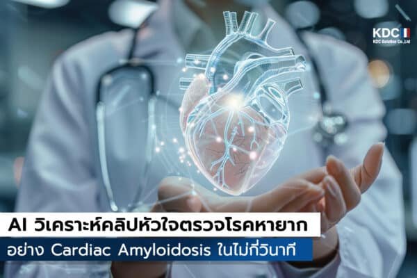 EchoGo Amyloidosis