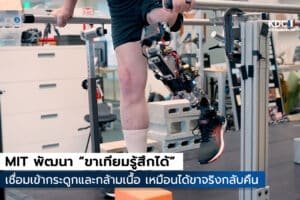 MIT พัฒนา “ขาเทียมรู้สึกได้”