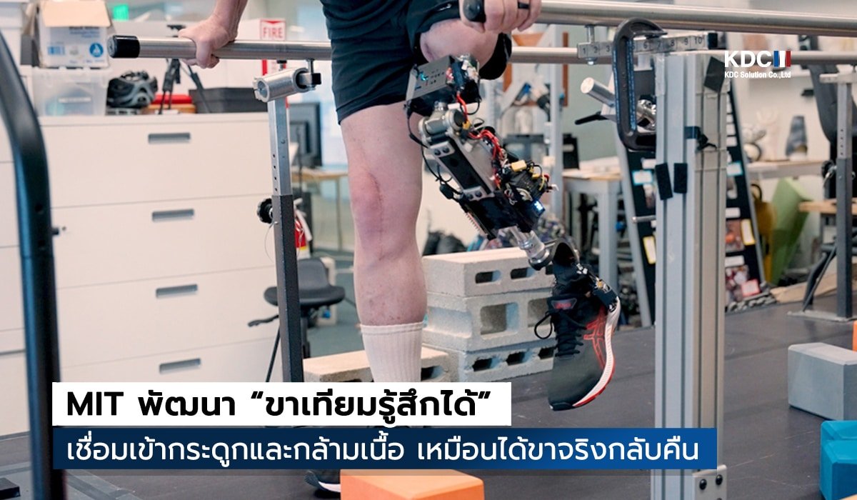 MIT พัฒนา “ขาเทียมรู้สึกได้”