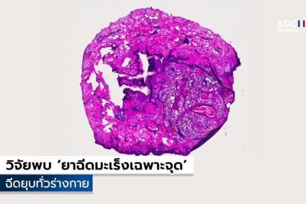 Antibody 2141-V11