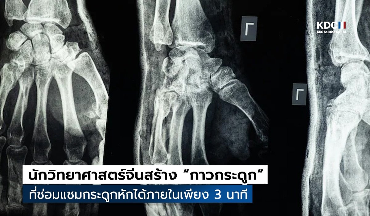 Bone-02