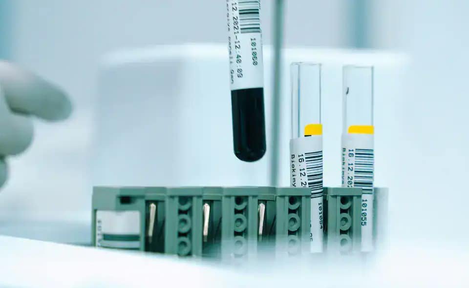 กรุ๊ปเลือดหายากที่สุดในโลก