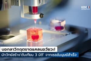 3D Bioprinting