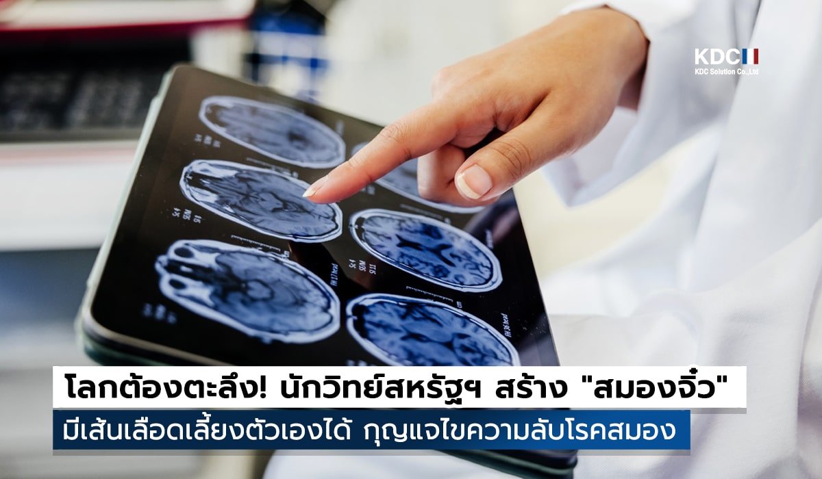 Brain Organoids