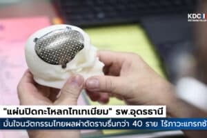 Titanium Cranial Implant