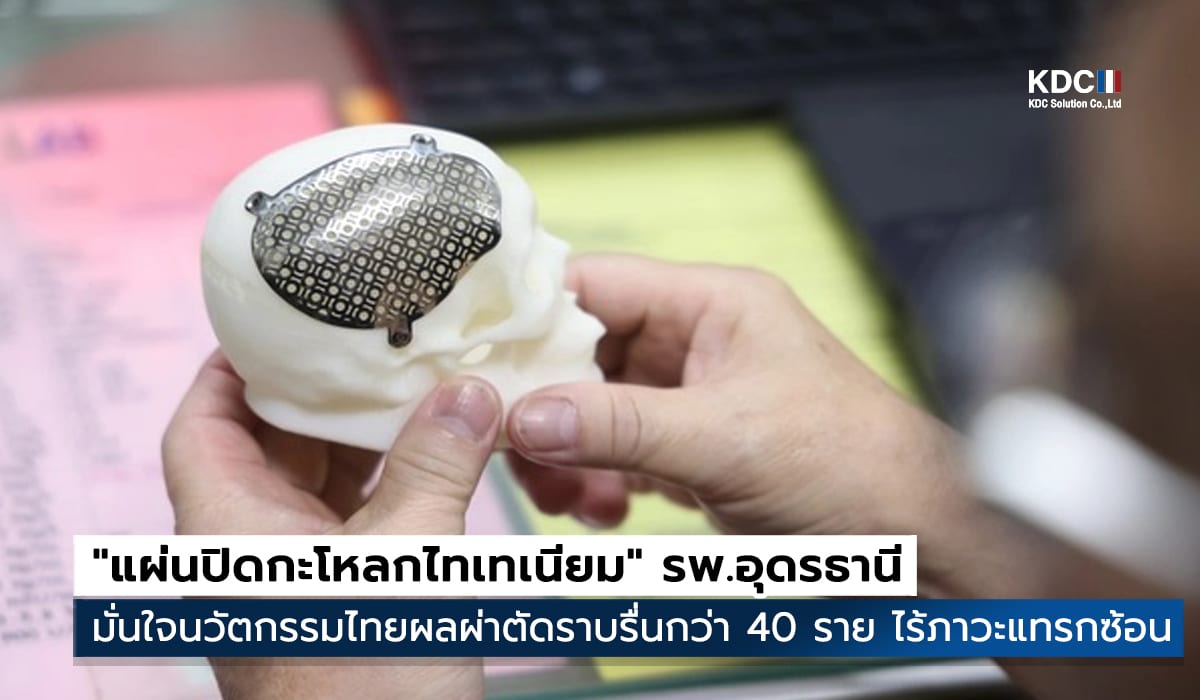 Titanium Cranial Implant