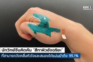 WE-PPD