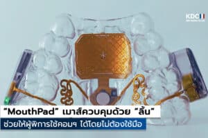 MouthPad