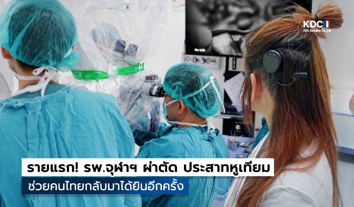 Cochlear Implant